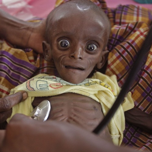 A Feast of Famine Pictures From Somalia … and What a Photo "Ought to Do"