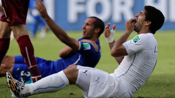 Luis Suarez Bite World Cup