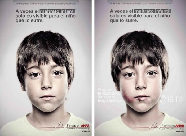 A Spanish charity has revealed a unique poster that only reveals an anti-abuse helpline to children.The Anar foundation poster can only be fully seen when looked at from a child's point of view due to a lenticular printing technique more often seen in novelty postcards.When an child sees it, they see the message 'If somebody hurts you, phone us and we'll help you,' while an adult simply sees an image of a frightened child.The foundation said it hoped the poster would help children gain confidence to call the number.The campaign was designed get the information about where to find help to children who may be accompanied by their abuser.The foundation was concerned that if a poster containing a phone number that both adult and child could see, the adult may possibly say things to dissuade the child from considering seeking help.'It is a message exclusively for them, hidden from adult's eyes' said Grey Spain, the agency behind the poster.'It uses a lenticular to combine two images, and we have calculated an area visible only by children under ten - and a warning for adults.' (PICTURE BY©Anar foundation)PHOTOGRAPH PROVIDED BY IBERPRESS+393358099068http://www.iber-press.com/redazione@iber-press.com