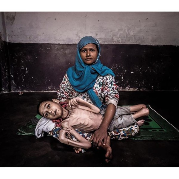 This image comes from my ongoing 'Bhopal Toxic Trespass' work highlighting the catastrophic effects from the thousands of tons of carcinogenic #chemicals that continue to #poison the Bhopal (India) aquifer today. The worlds-worst ever #industrial accident site - that killed over 10,000 immediately in December 1984- was never cleaned up and the former pesticide plant still lies rusting and polluting the area over 31 years later. photo: Giles Clarke.