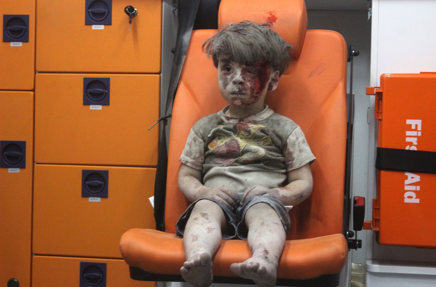 Omran and Alan: The Limits of the Photo of the Wounded Aleppo Boy